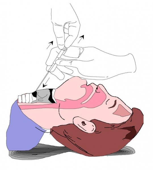 File:Needle Crich 3.jpg