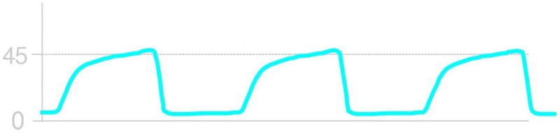 File:ETCO2 Bronchospasm.jpg