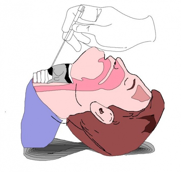 File:Needle Crich 2.jpg